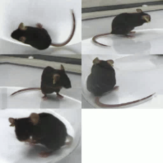 驼背